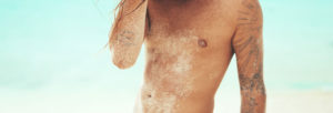 Epilation laser sur Lyon
