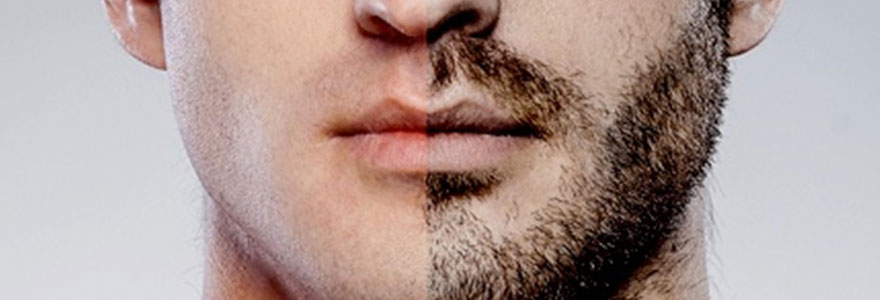 greffe de barbe